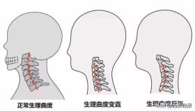 照片熱傳！不少年輕人在醫(yī)院“吊脖子”？醫(yī)生提醒