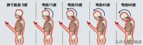 照片熱傳！不少年輕人在醫(yī)院“吊脖子”？醫(yī)生提醒